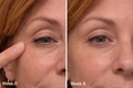 Cellume Skin Repair Pro | LED Light Therapy Mask 3